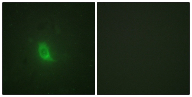 Phospho-Separase (Ser801) Antibody in Immunocytochemistry (ICC/IF)