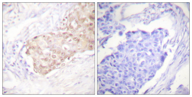 HYD Antibody in Immunohistochemistry (Paraffin) (IHC (P))