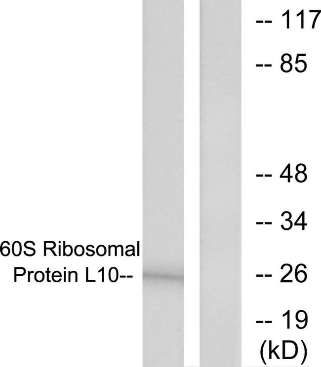 RPL10 Antibody in Western Blot (WB)