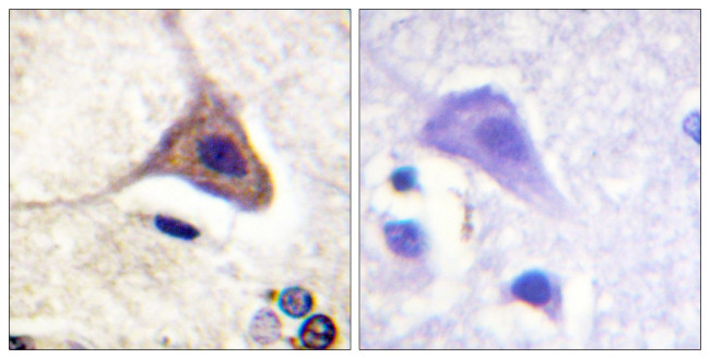 Phospho-OPRD1 (Ser363) Antibody in Immunohistochemistry (Paraffin) (IHC (P))