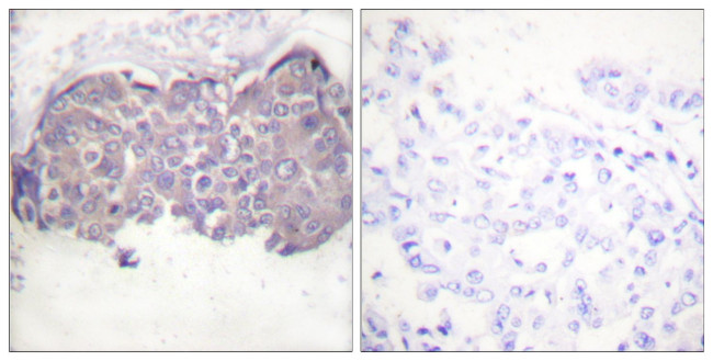 Phospho-HSL (Ser552) Antibody in Immunohistochemistry (Paraffin) (IHC (P))