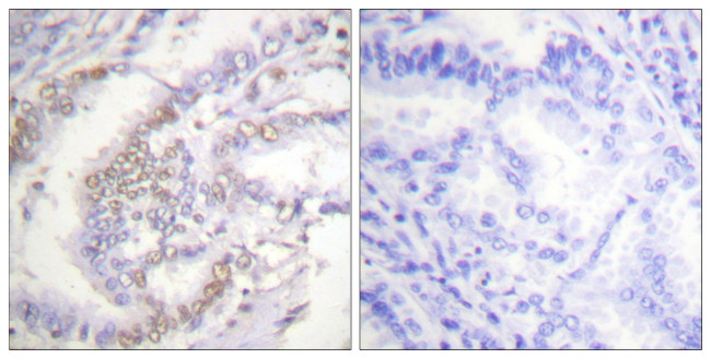 Phospho-Ku70 (Ser5) Antibody in Immunohistochemistry (Paraffin) (IHC (P))