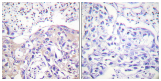 Phospho-alpha Adducin (Thr445) Antibody in Immunohistochemistry (Paraffin) (IHC (P))