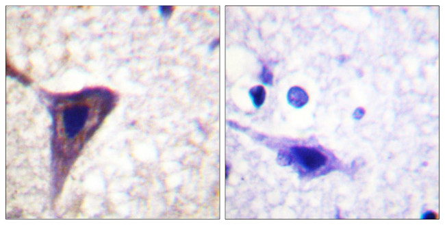 Phospho-BID (Ser78) Antibody in Immunohistochemistry (Paraffin) (IHC (P))