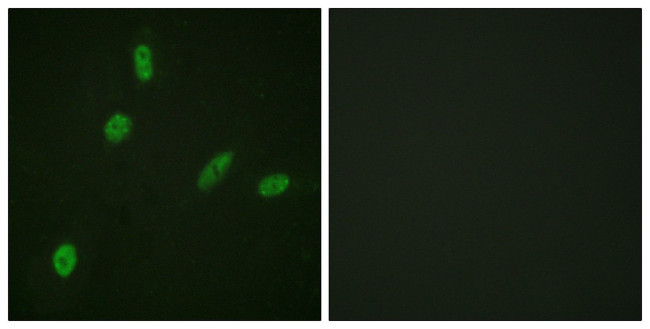 ETS1 Antibody in Immunocytochemistry (ICC/IF)