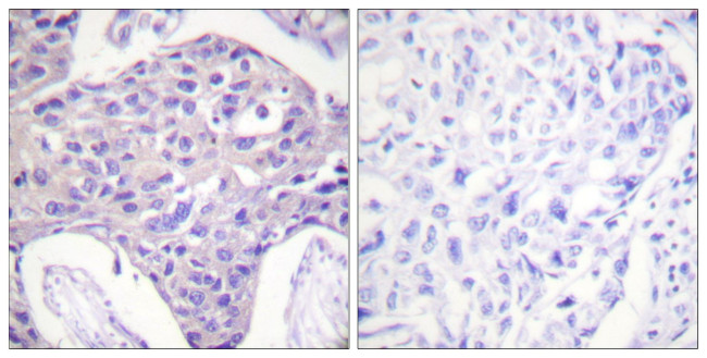 FOXO1/FOXO3/FOXO4 Antibody in Immunohistochemistry (Paraffin) (IHC (P))