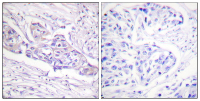 Phospho-FOXO1 (Ser329) Antibody in Immunohistochemistry (Paraffin) (IHC (P))