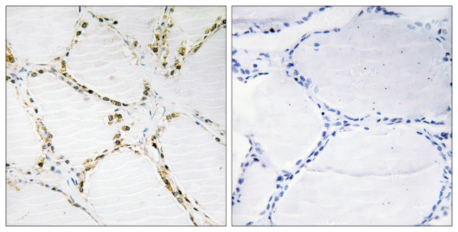 FOXO1/FOXO3 Antibody in Immunohistochemistry (Paraffin) (IHC (P))