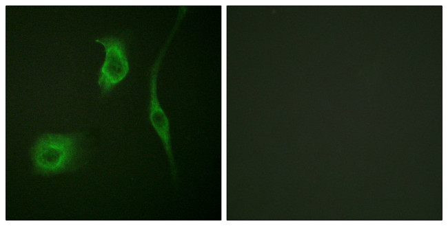 Phospho-HSP20 (Ser16) Antibody in Immunocytochemistry (ICC/IF)