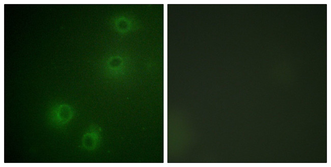 Phospho-ITGB1 (Thr789) Antibody in Immunocytochemistry (ICC/IF)
