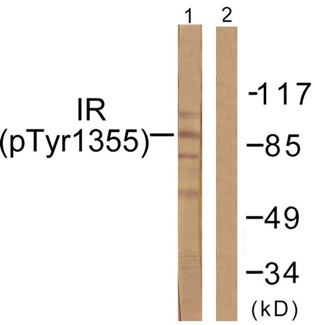 Phospho-INSR (Tyr1355) Antibody in Western Blot (WB)