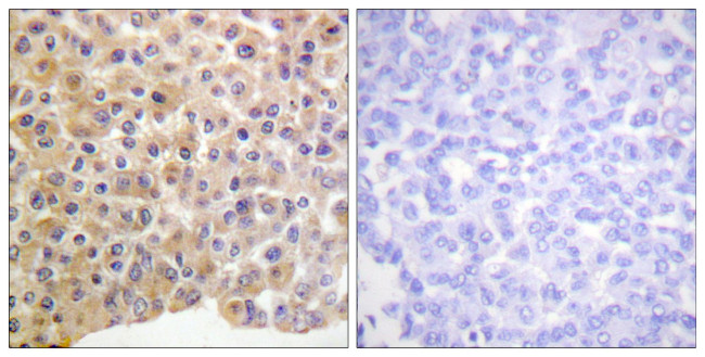 Phospho-INSR (Tyr1361) Antibody in Immunohistochemistry (Paraffin) (IHC (P))