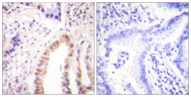 Phospho-MEF2D (Ser444) Antibody in Immunohistochemistry (Paraffin) (IHC (P))