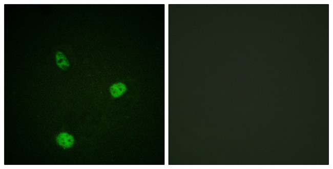 MiTF Antibody in Immunocytochemistry (ICC/IF)