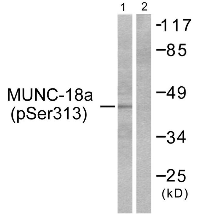 Phospho-MUNC18 (Ser313) Antibody in Western Blot (WB)