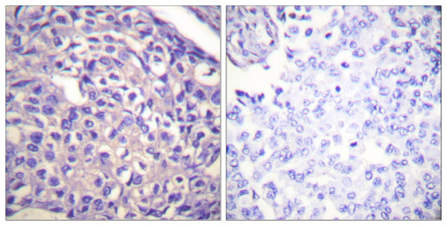 MYPT1 Antibody in Immunohistochemistry (Paraffin) (IHC (P))