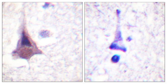 MYPT1 Antibody in Immunohistochemistry (Paraffin) (IHC (P))