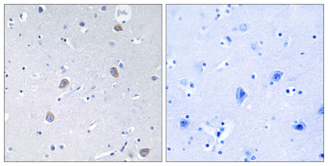 Phospho-p70 S6 Kinase (Ser371) Antibody in Immunohistochemistry (Paraffin) (IHC (P))