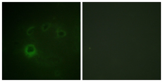 Phospho-p70 S6 Kinase (Ser418) Antibody in Immunocytochemistry (ICC/IF)