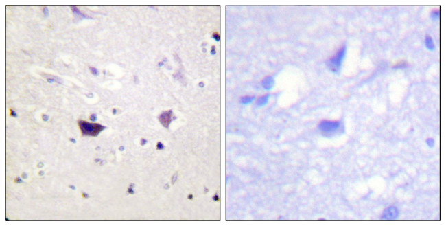 PAK1/2/3 Antibody in Immunohistochemistry (Paraffin) (IHC (P))