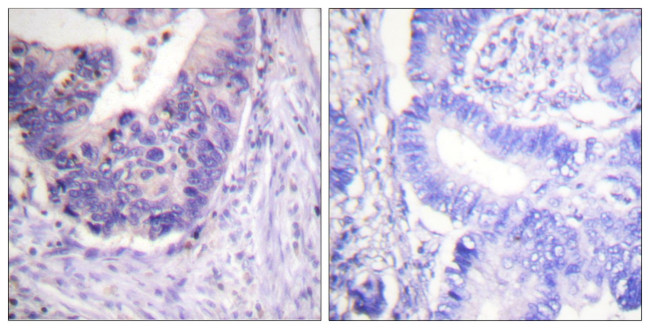 Phospho-PDE4D (Ser53, Ser190) Antibody in Immunohistochemistry (Paraffin) (IHC (P))