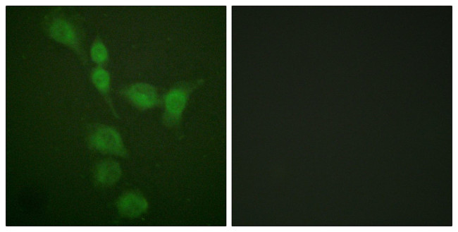 PKA alpha/beta Antibody in Immunocytochemistry (ICC/IF)