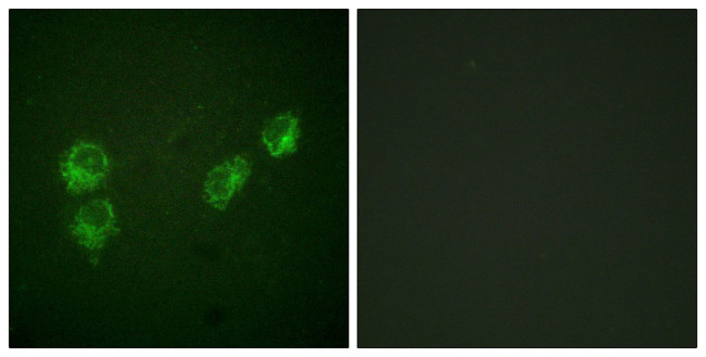 Phospho-Phospholamban (Ser16, Thr17) Antibody in Immunocytochemistry (ICC/IF)