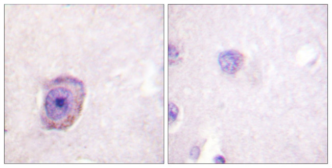 Phospho-Rhodopsin (Ser334) Antibody in Immunohistochemistry (Paraffin) (IHC (P))