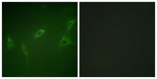 RyR2 Antibody in Immunocytochemistry (ICC/IF)