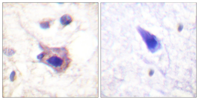 Phospho-Syk (Tyr323) Antibody in Immunohistochemistry (Paraffin) (IHC (P))