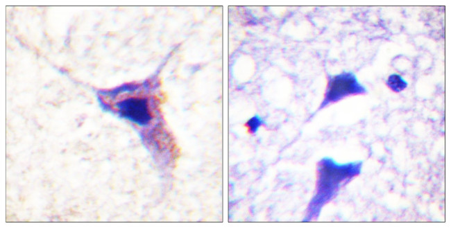 Phospho-Synapsin 1 (Ser62) Antibody in Immunohistochemistry (Paraffin) (IHC (P))