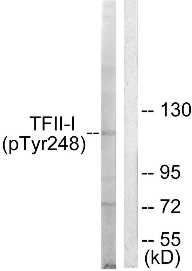 Phospho-GTF2I (Tyr248) Antibody in Western Blot (WB)