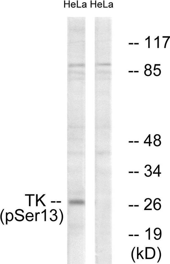 Phospho-TK1 (Ser13) Antibody in Western Blot (WB)