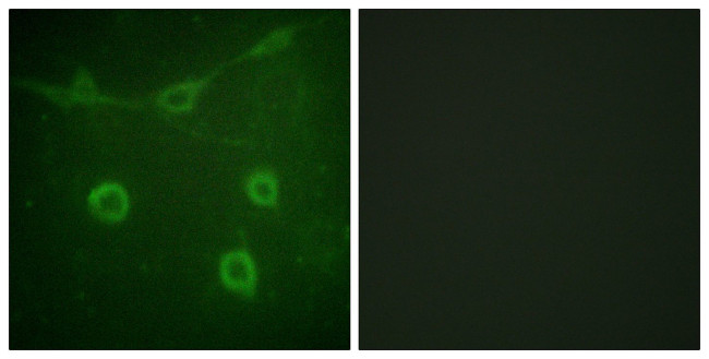 Phospho-TrkA (Tyr496) Antibody in Immunocytochemistry (ICC/IF)