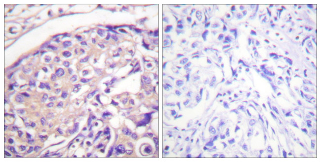 Phospho-TSC2 (Thr1462) Antibody in Immunohistochemistry (Paraffin) (IHC (P))