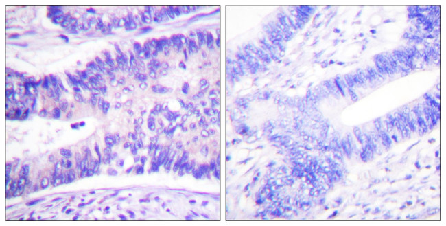 Phospho-WAVE1 (Tyr125) Antibody in Immunohistochemistry (Paraffin) (IHC (P))