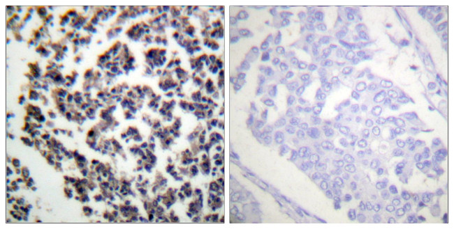 Phospho-BLNK (Tyr96) Antibody in Immunohistochemistry (Paraffin) (IHC (P))