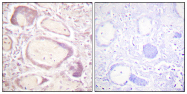 Phospho-Cyclin B1 (Ser147) Antibody in Immunohistochemistry (Paraffin) (IHC (P))