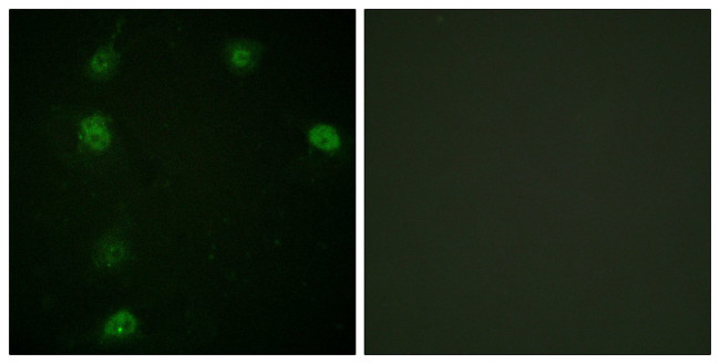 Phospho-Cyclin E (Thr77) Antibody in Immunocytochemistry (ICC/IF)