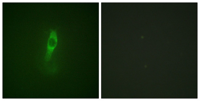 Phospho-ETK (Tyr40) Antibody in Immunocytochemistry (ICC/IF)