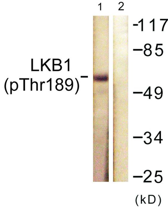 Phospho-LKB1 (Thr189) Antibody in Western Blot (WB)