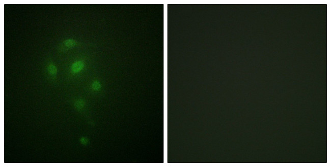 Phospho-MSK1 (Thr581) Antibody in Immunocytochemistry (ICC/IF)