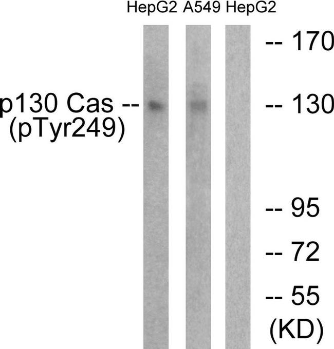 Phospho-p130Cas (Tyr249) Antibody in Western Blot (WB)