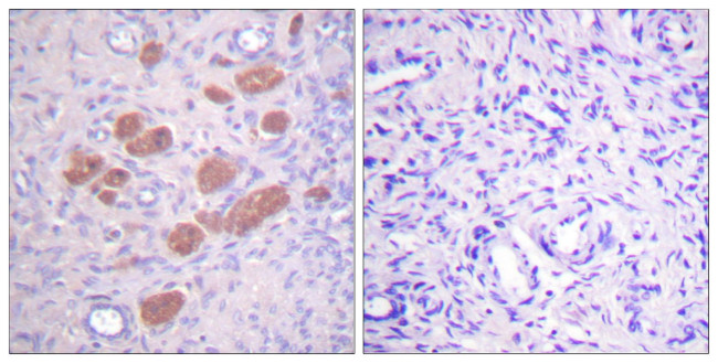 Phospho-NCF4 (Thr154) Antibody in Immunohistochemistry (Paraffin) (IHC (P))