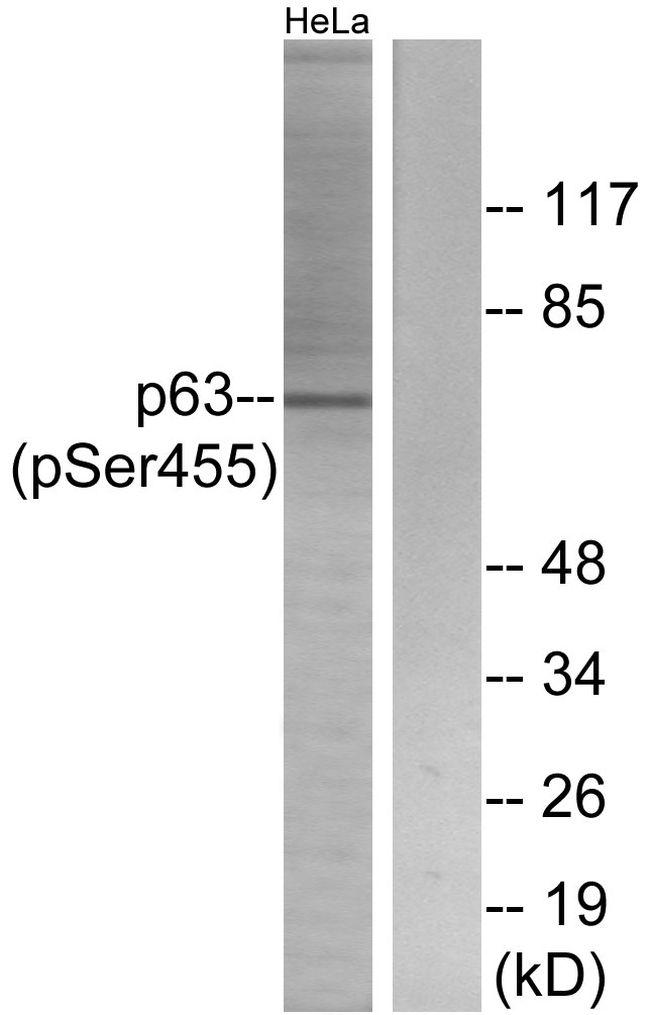 Phospho-p63 (Ser455) Antibody in Western Blot (WB)