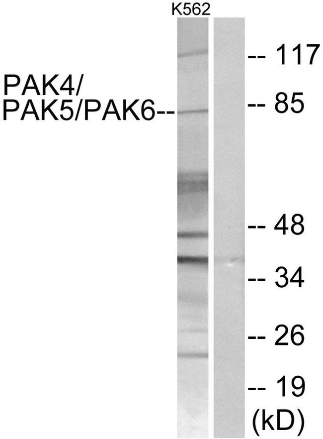 PAK4/6/7 Antibody in Western Blot (WB)