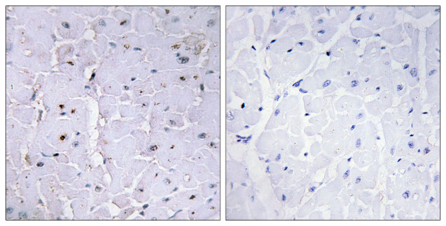 Phospho-PIN1 (Ser16) Antibody in Immunohistochemistry (Paraffin) (IHC (P))