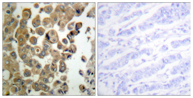 Phospho-PKC delta (Thr505) Antibody in Immunohistochemistry (Paraffin) (IHC (P))