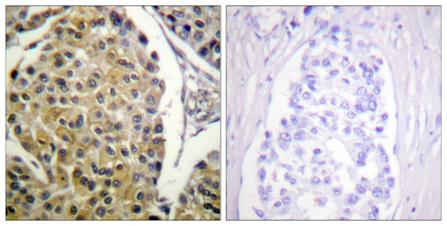 Phospho-PKC delta (Tyr313) Antibody in Immunohistochemistry (Paraffin) (IHC (P))