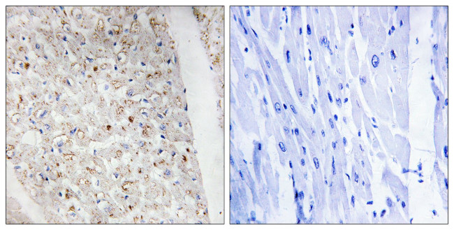 Phospho-PKD1/2/3/PKC mu (Ser738, Ser742) Antibody in Immunohistochemistry (Paraffin) (IHC (P))